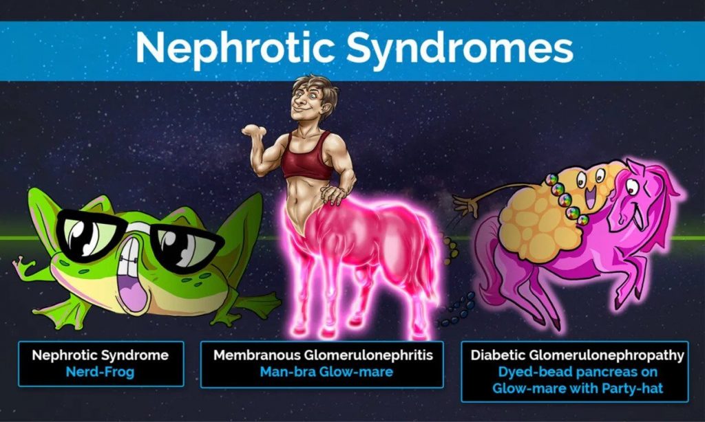 Nephrotic Syndromes picmonic 