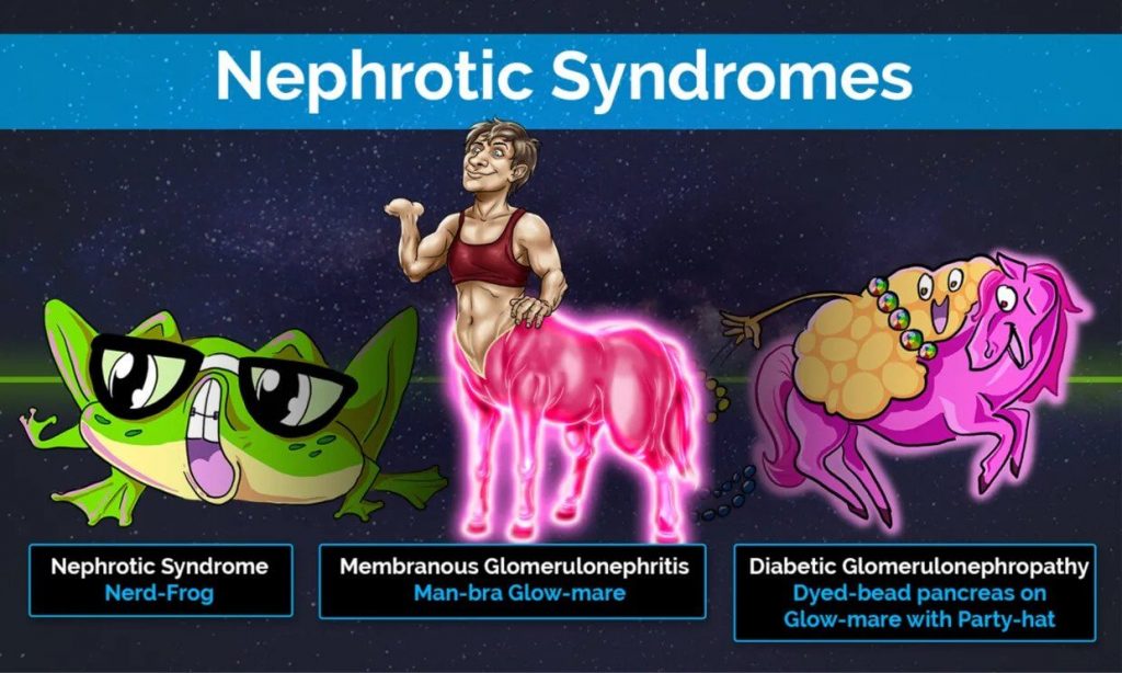 Nephrotic Syndromes picmonic