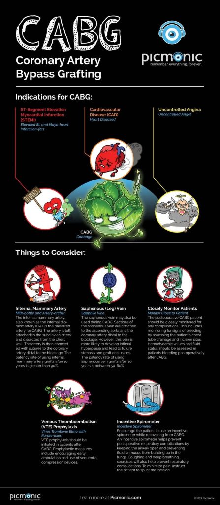 CABG - Coronary Artery Bypass Grafting Infographic