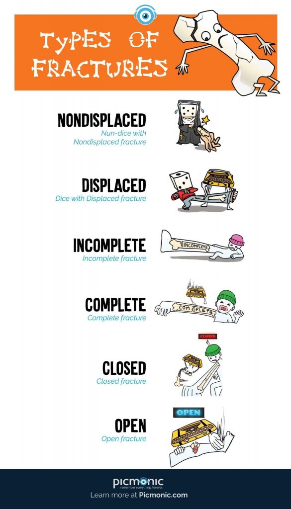 Types of Fracture